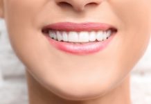Dental Bonding: What You Should Know Before the Treatment